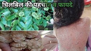 चिलबिल के अनसुने फायदे, Holoptelea integrifolia बेनिफेट्स इन हिन्दी