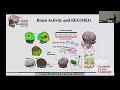 Dynamic Brain Mapping and Brain-Computer Interface
