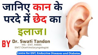 जानिए कान के परदे में छेद का इलाज |Best Treatment for Ear Drum Hole| Dr. Swati Tandon