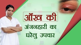 आँख की अंजनहारी का घरेलु उपचार | Acharya Balkrishna