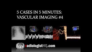 5 Cases in 5 Minutes: Vascular #4