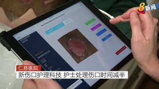 仁慈医院试行3D伤口管理科技 为患者提供适当治疗