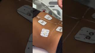 Effortless muscle toning with the world’s FIRST whole-body muscle stimulator, Pure Impact by Sofwave