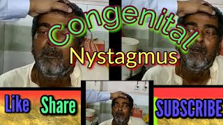 Congenital Nystagmus