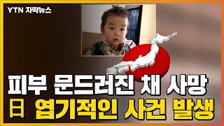 [자막뉴스] 3살 아이 피부 문드러진 채 사망...日 엽기적인 사건 발생 / YTN