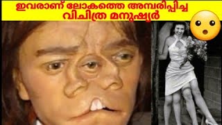 വിചിത്ര മനുഷ്യർ/strange people in the world/extra organs in human/horizon world