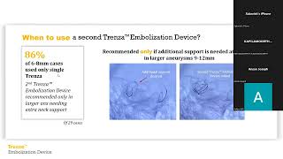 Dr. Sabareesh | Case presentation and Discussions on intrasaccular flow diverters / MT on CVT