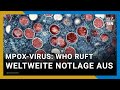 WHO: Weltweite Notlage wegen neuer Variante von Mpox-Virus | Nicht genügend Impfstoff