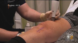 New Procedure Takes Pain Out Of Knee Replacement Surgery