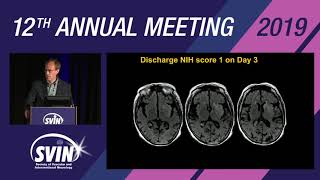 SVIN 2019: The Best Way to Image Core Infarct: MRI