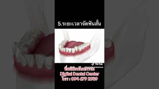 8 ข้อดีของการจัดฟันแบบใส invisalign