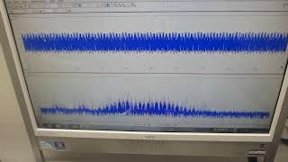 メガヘルツ超音波の表面弾性波制御技術（超音波システム研究所）