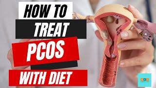 Unlock the Secret PCOD Diet Plan - Why Diet is Key to Treating PCOD!