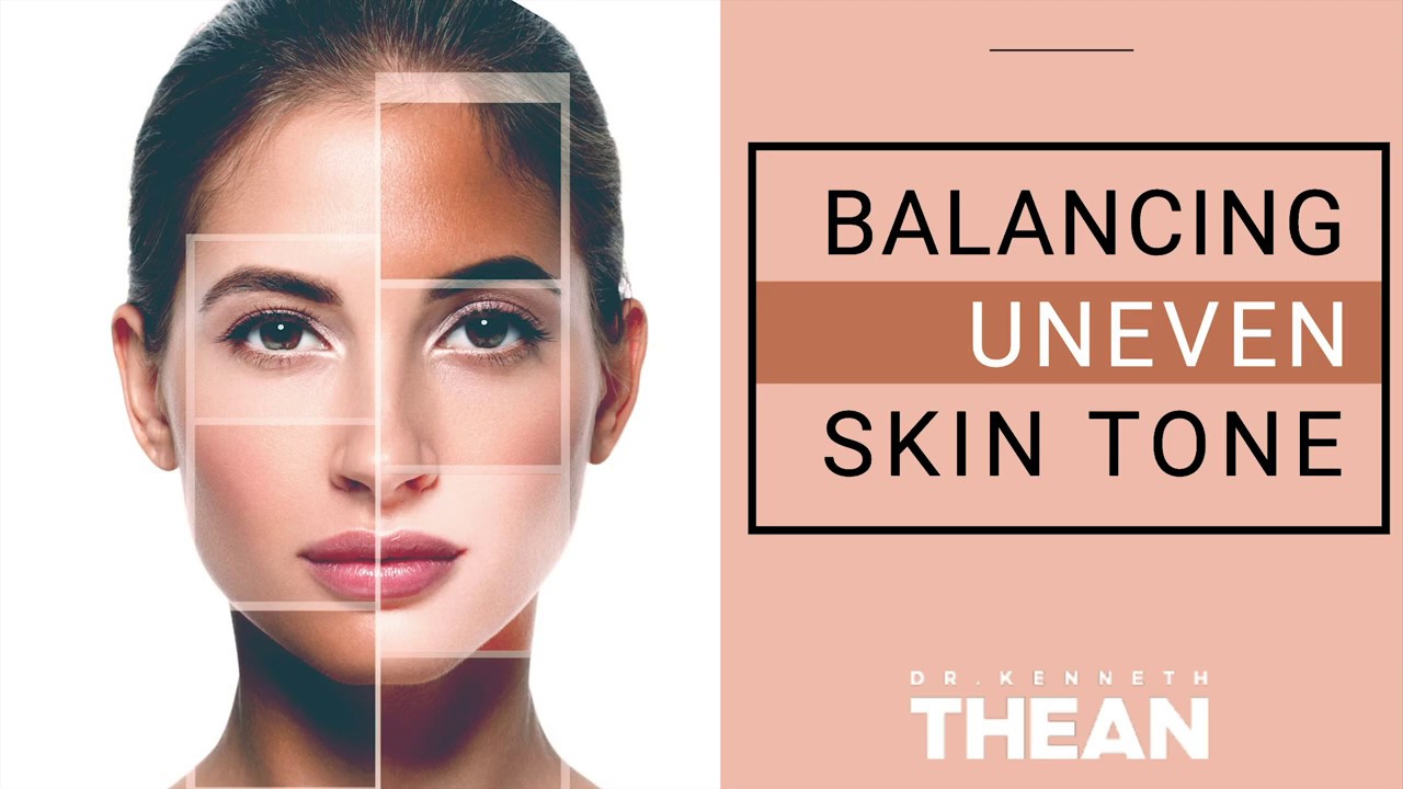 What Causes Uneven Skin Tone & How To Treat It Naturally? - YouTube