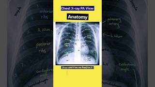 Chest X-ray Anatomy #shorts #xray