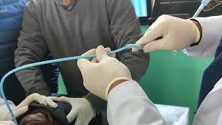 Surgical Cricothyrotomy