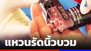 ช่วยยายวัย 83  สวมแหวนนิ้วบวม | ข่าวช่อง8