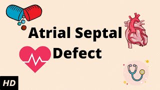 ATRIAL SEPTAL DEFECT (ASD), Causes, Signs and Symptoms, Diagnosis and Treatment.