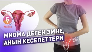 Миома деген эмне? Гинеколог Эльвира Кадыркулова жооп берди