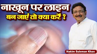 नाखून पर लाइन बन जाएं तो क्या करें ? Hakim Suleman Khan | Sadhna TV