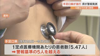 急性ウイルス性感染症の「手足口病」が流行　県が2年8か月ぶりに “警報” 発表