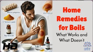 Boils Treatment at Home – Do’s \u0026 Don’ts!