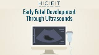 Ultrasounds and Early Fetal Development (English)
