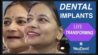 Full mouth dental implant , best dentist in india ,best dental implant center in india,allon4imants