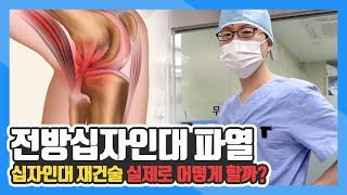 실제 십자인대 파열 수술 ｜전방 십자인대재건술 후기