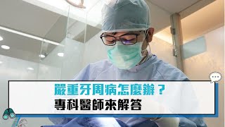 【CNEWS】 嚴重牙周病怎麼辦？ 專科醫師來解答