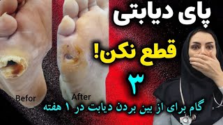 ۳ گام برای از بین بردن دیابت در یک هفته | دیابت را از بین ببرید و قند خونتان را کاهش دهید.