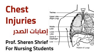 Chest Injuries | إصابات الصدر