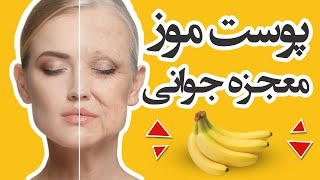 خواص پوست موز و ۸ کاربرد آن درسلامت و زیبایی پوست