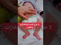 مساج لعلاج الغازات والمغص عند الرضيع@drnasrenalfraik الاطفال دنسرين_الفريخ