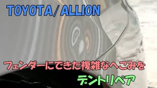 TOYOTA/ALLIONのフロントフェンダーに出来たガッツリへこみをデントリペア