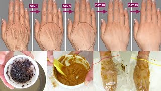 How to make your hands look 5 years younger | Wrinkle free smooth fair hands