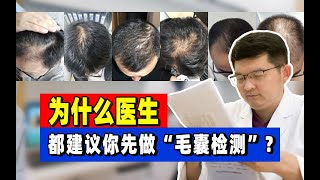 【毛囊檢測】脫髮了為什麼要做毛囊檢測？毛囊是如何退化閉合的？與你的脫髮息息相關！丨植髮醫生徐魯