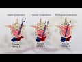 Spine EDG® by EDGe Surgical - (3-in-1 Device - Animation Video)