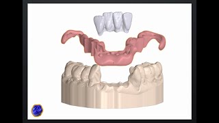 B4D Dental Modules-Zoom Immediate Partial