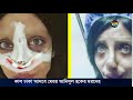 deepto news special story অ্যাঞ্জেলিনা জোলির চেহারা পেতে তরুণীর ৫০ বার সার্জারি