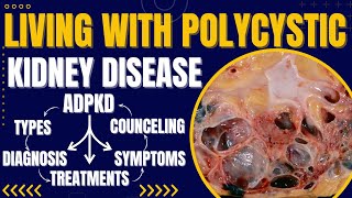 Understanding Autosomal Dominant Polycystic Kidney Disease (PKD): Symptoms, Causes, and Treatment ✨