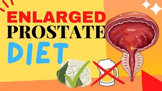 ENLARGED PROSTATE? DIET ADVICE - FOODS TO EAT AND FOODS TO AVOID!