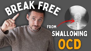 Can’t Stop Noticing Swallowing? How to Break Free from Swallowing OCD