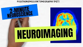 2-Minute Neuroscience: Neuroimaging