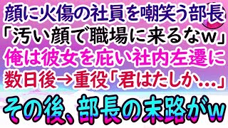 【感動する話】顔に火傷がある陰キャ社員を見下す上司「化粧くらいしろバケモノがw」彼女を庇った俺は窓際部署に社内左遷させられた。ある日→会社の重役が視察に来ると「君は確か…」俺「あ！」【泣ける