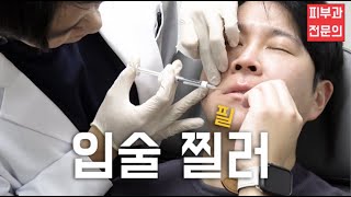 키스를 부르는 입술 필러 I  Ep41