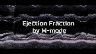 Ejection Fraction by M-Mode