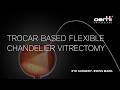 Trocar Based Flexible Chandelier Vitrectomy | Intraocular Illumination | Vitreoretinal Surgery