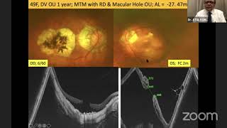 AIOC2021- IC475 - Topic - Dr. ATUL KUMAR