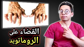 كيف تتخلص من إلتهاب المفاصل الروماتويدي للأبد وبدون أدوية